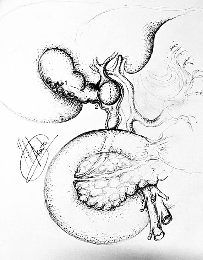 Fig. 1