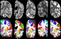 Figure 3: