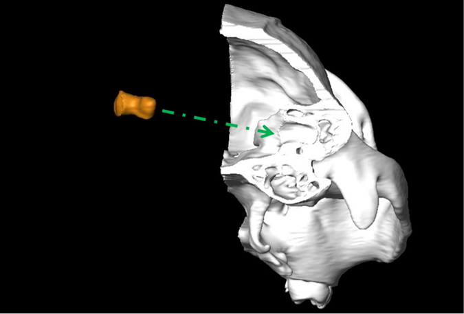 Figure 4