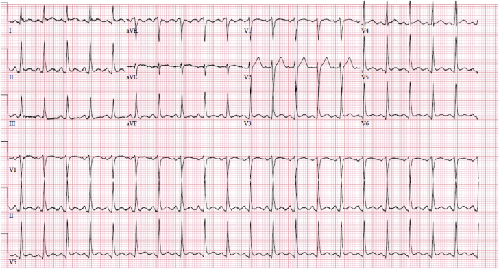 Figure 1