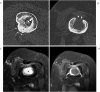 Fig. 10