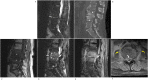 Fig. 13