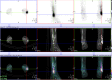 Fig. 11