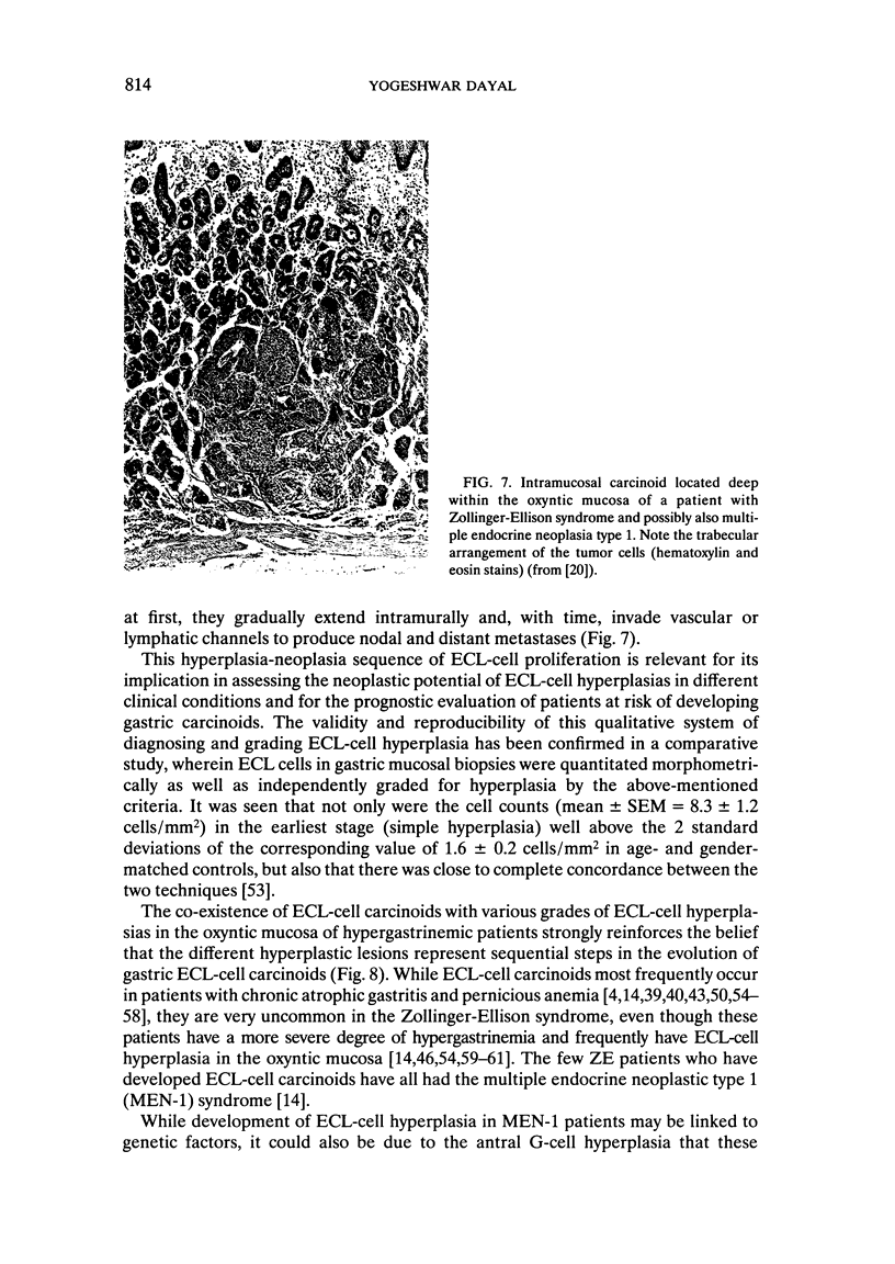 Hyperplastic proliferations of the ECL cells - PMC