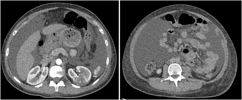 Fig. 2