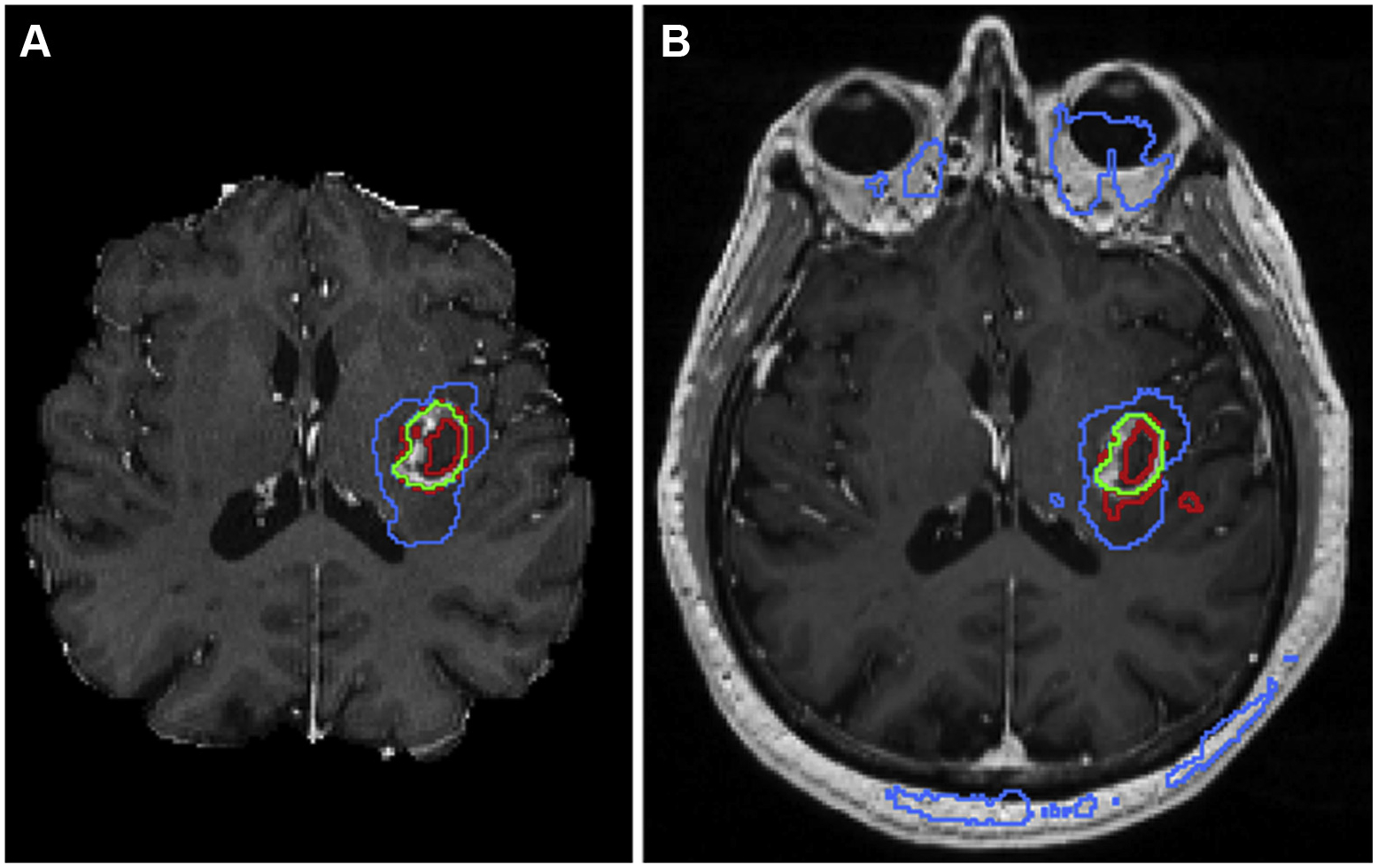 Fig 2.