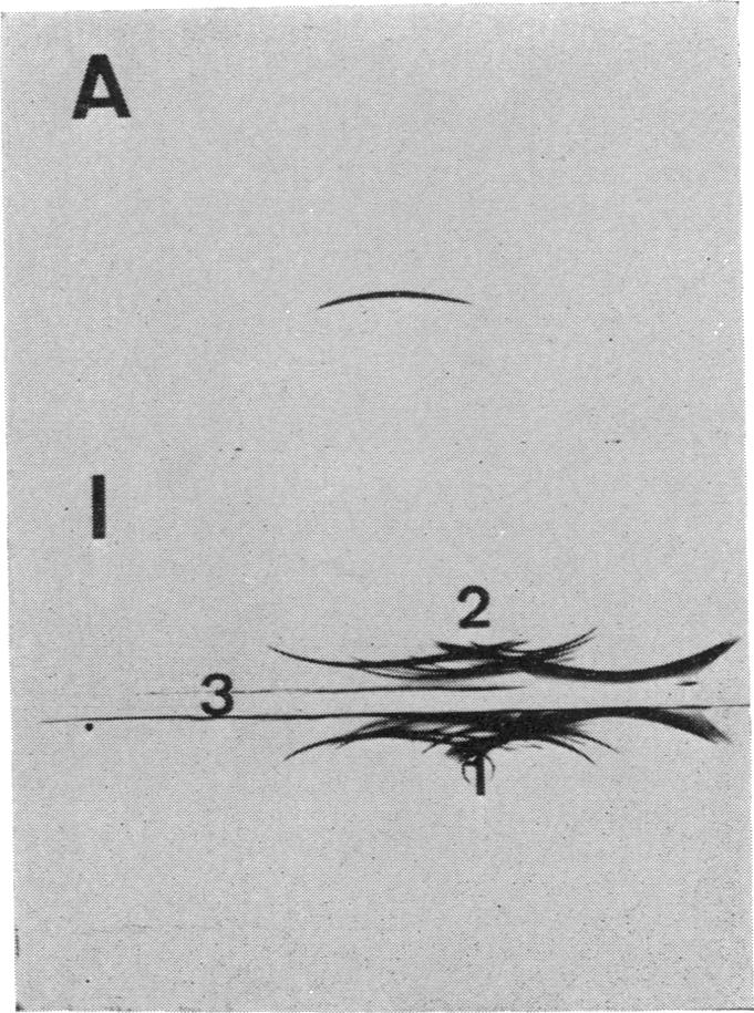 FIG. 10