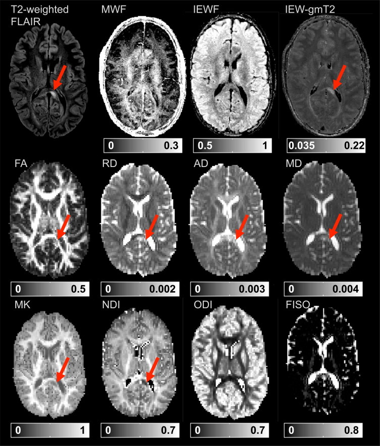 Fig. 2