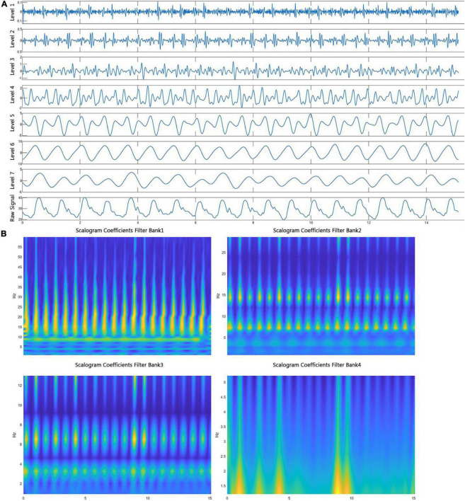 FIGURE 3