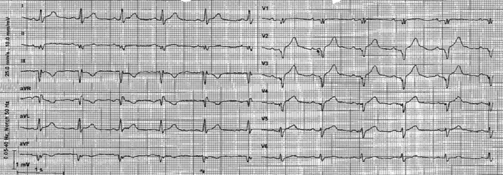 Figure 1