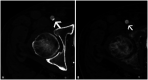 Fig. 13