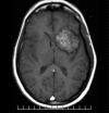 Figure 3A