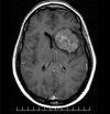 Figure 3B