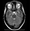 Figure 2A
