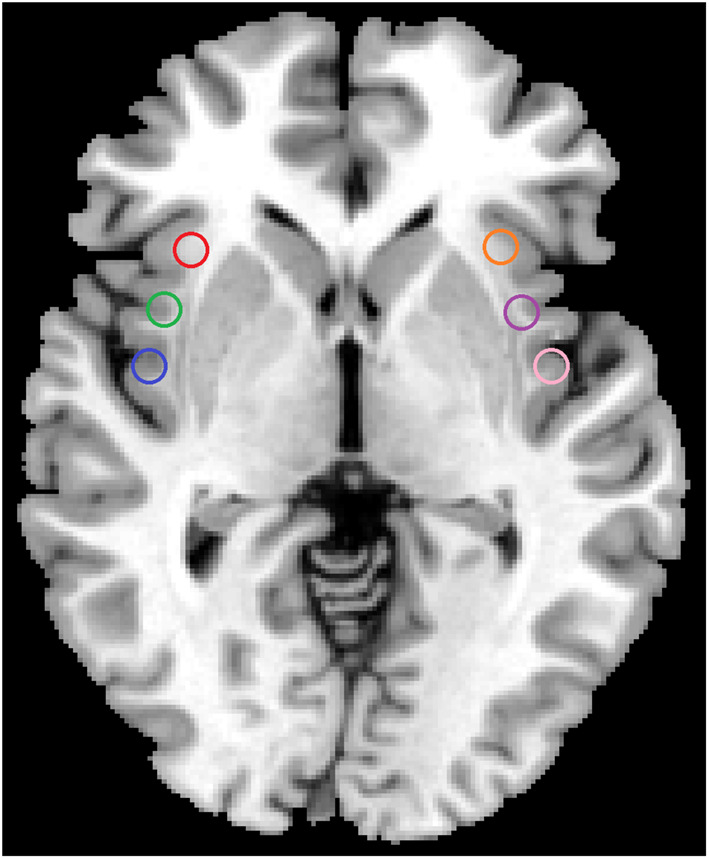 Fig. 1