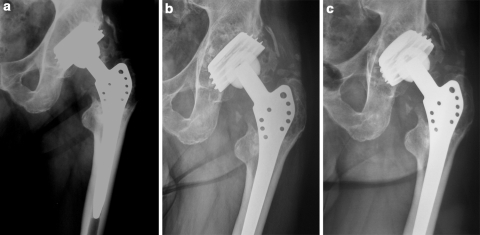 Fig. 1a–c