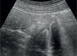 Fig. 8 B