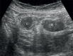 Fig. 7 A