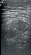 Fig. 7 B