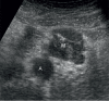 Fig. 6 A