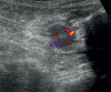 Fig. 8 A