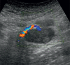 Fig. 6 B