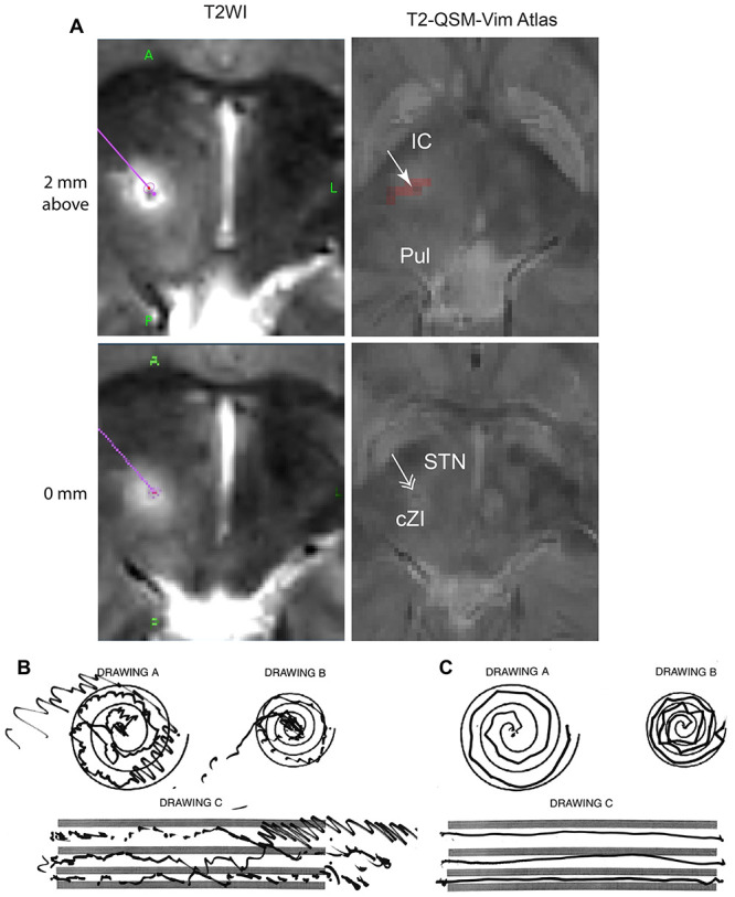 FIG. 4