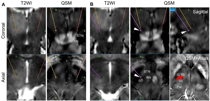 FIG. 3