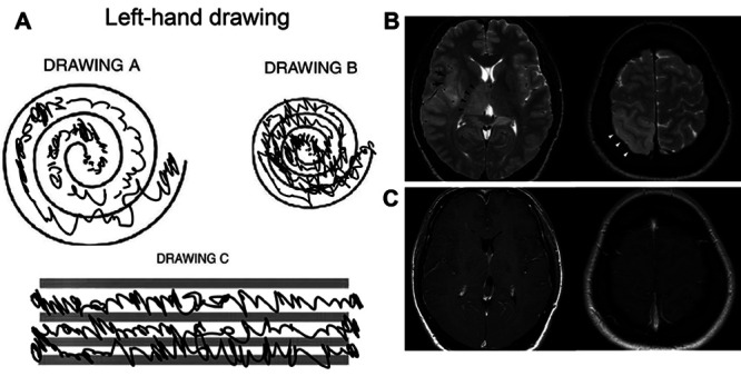 FIG. 1