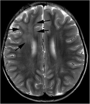 Fig. 11