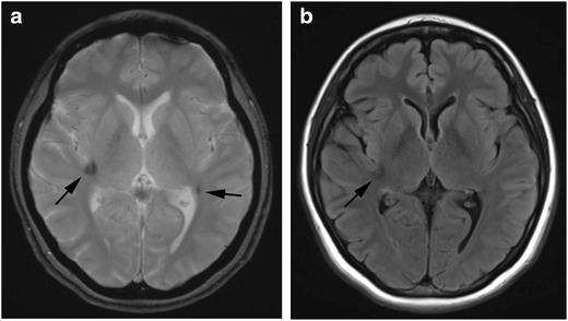 Fig. 10