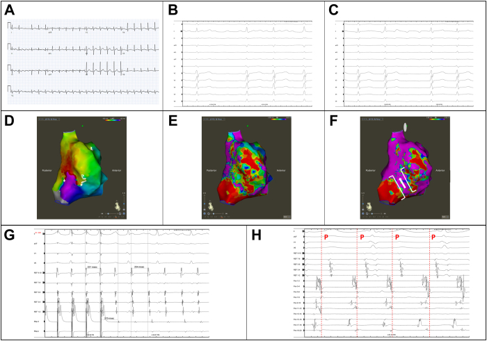 Figure 2