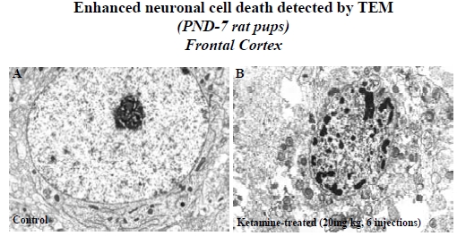 Fig. (1)