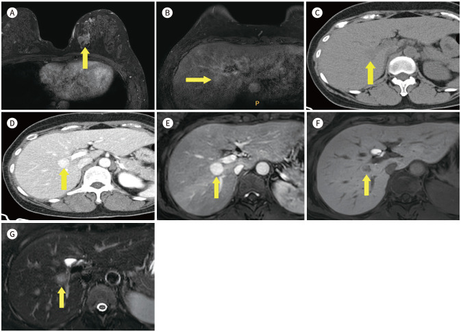 Fig. 14