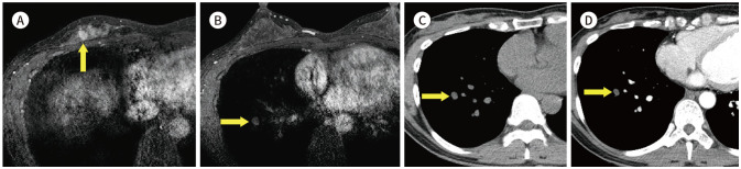 Fig. 12