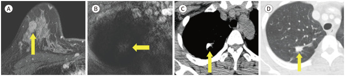 Fig. 11