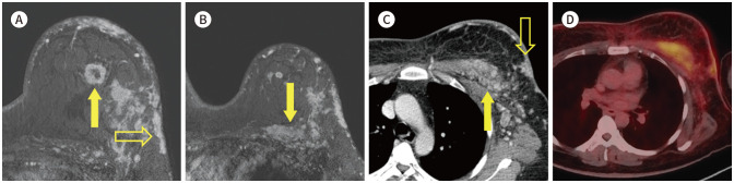 Fig. 21