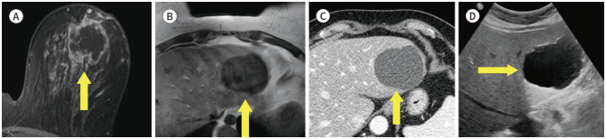 Fig. 13