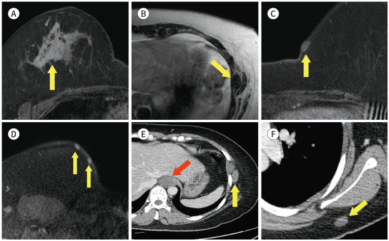 Fig. 22