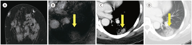 Fig. 10