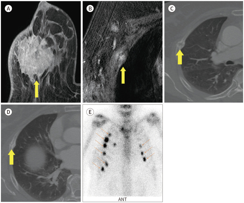 Fig. 20