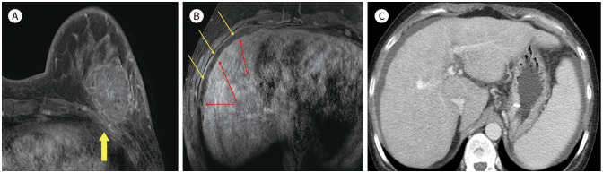 Fig. 15