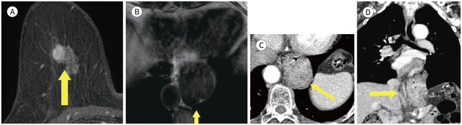 Fig. 17