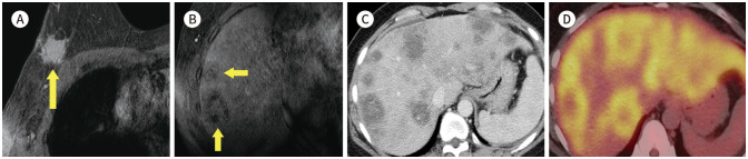 Fig. 18