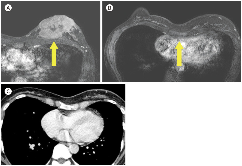 Fig. 23