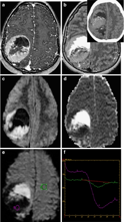 Fig. 5