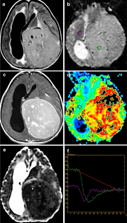 Fig. 6