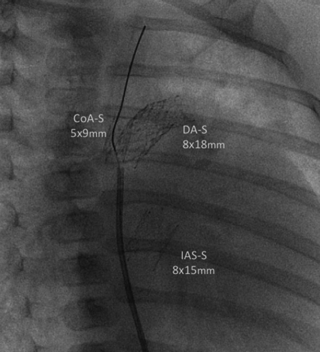 Fig. 1