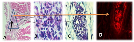 Fig. 14