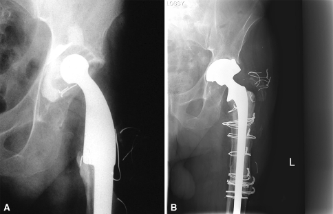 Fig. 3A–B